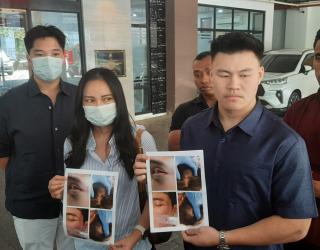 Polisi Tetapkan Tiga Tersangka Pengeroyokan Pelajar di Klub Malam Surabaya